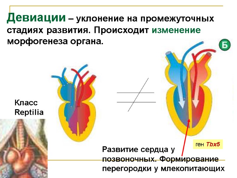 Девиации – уклонение на промежуточных стадиях развития. Происходит изменение морфогенеза органа. Развитие сердца у Девиации – уклонение на промежуточных стадиях развития. Происходит изменение морфогенеза органа. Развитие сердца у